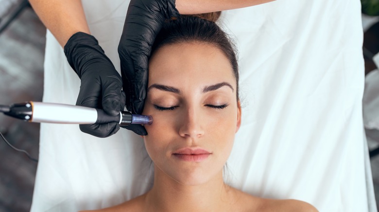 Microneedling: Tailoring Treatment to Suit Different Skin Types