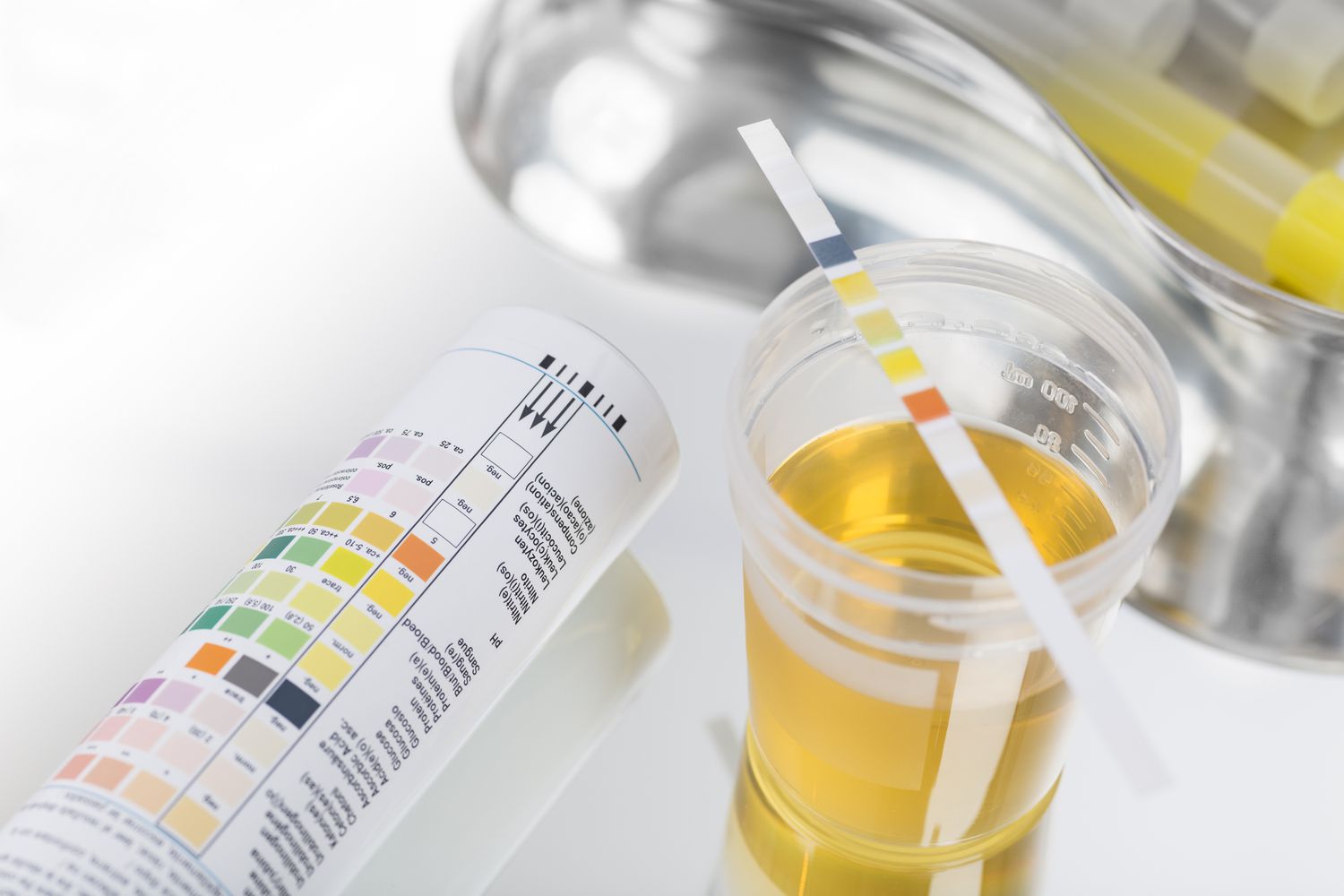 reliable solution for urine tests