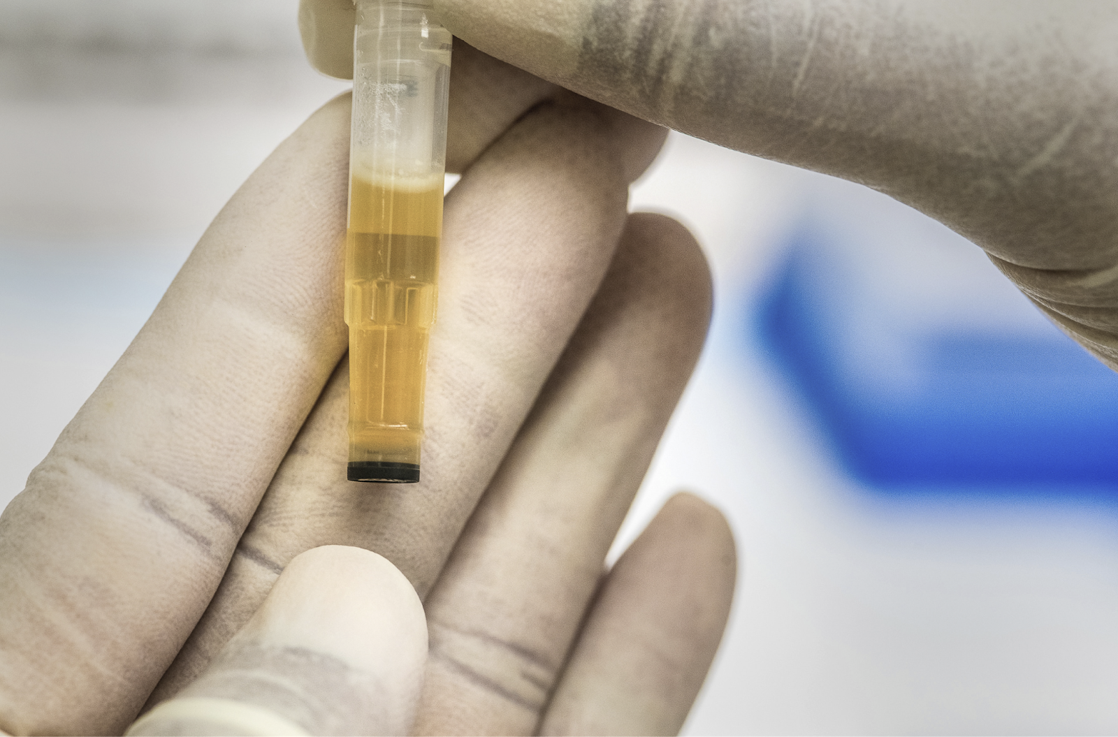 reliable solution for urine tests